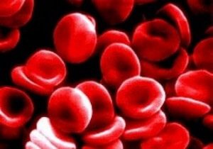 Anemia ferropriva: falta de ferro