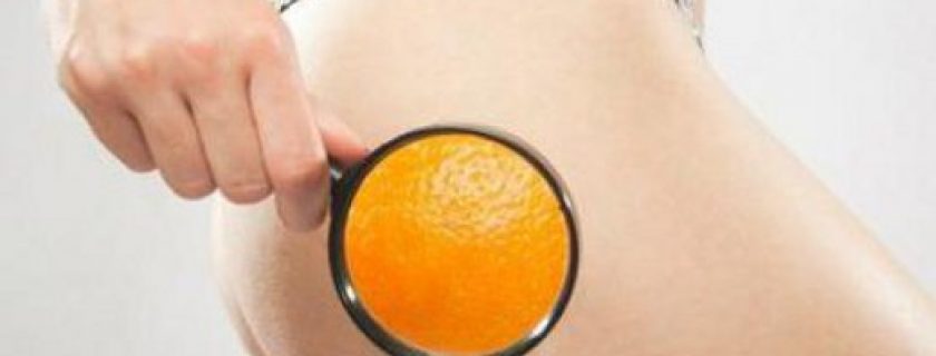 Como eliminar a celulite