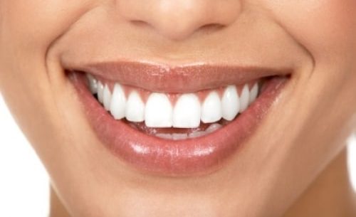 Dicas caseiras para branquear os dentes