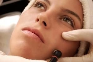 Radiofrequência facial para reafirmar sua pele