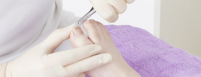 Remédios caseiros para tratar as unhas encravadas