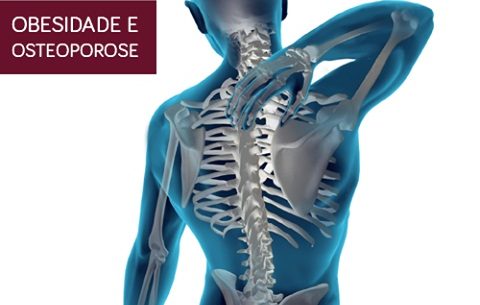 A obesidade aumenta o risco de osteoporose