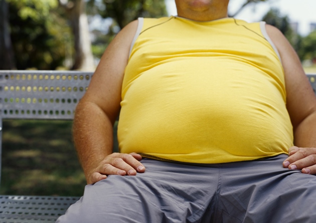 O que é obesidade mórbida?