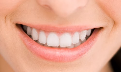 Como branquear os dentes de forma caseira