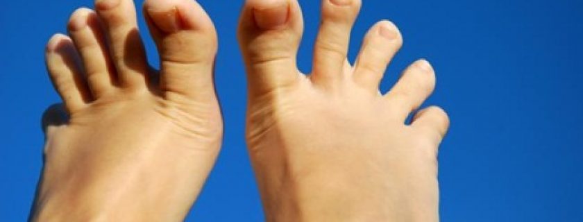 Corredores: Conselhos para cuidar das unhas
