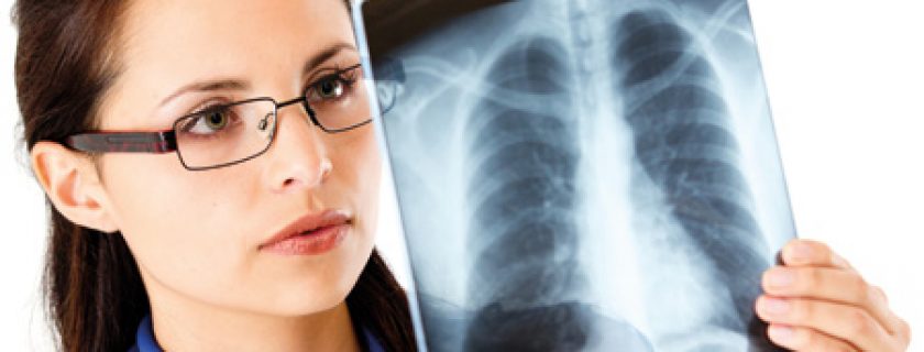 Tuberculose pulmonar