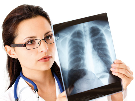 Tuberculose pulmonar