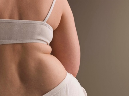 Obesidade e depressão muitas vezes ocorrem em conjunto