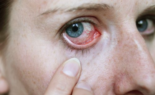 Seus olhos podem refletir seu estado de saúde