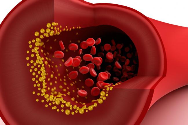 6 mitos sobre o colesterol que nunca devemos acreditar