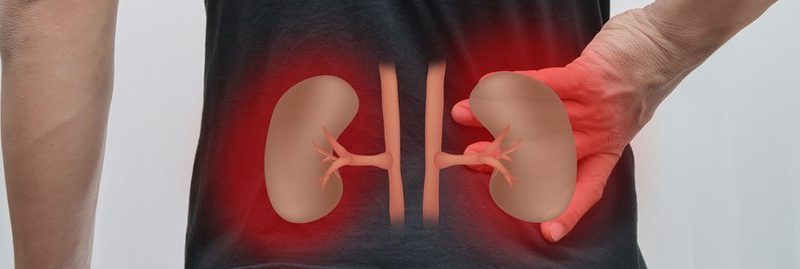 Cálculo renal: tipos, sintomas e dieta para prevenir