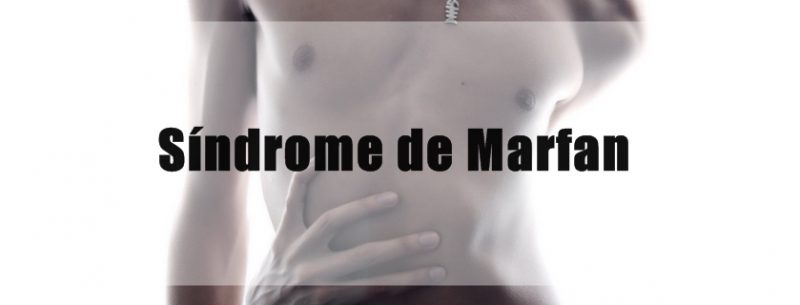 O que é Síndrome de Marfan e como tratar seus sintomas