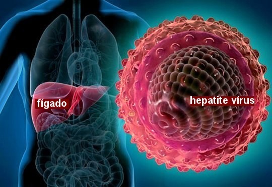 Hepatite