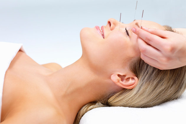 acupuntura