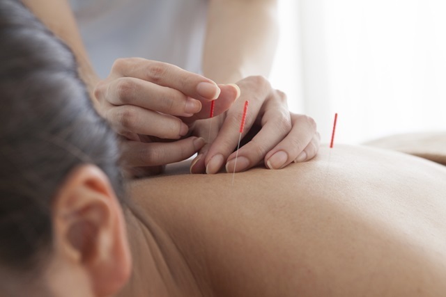acupuntura