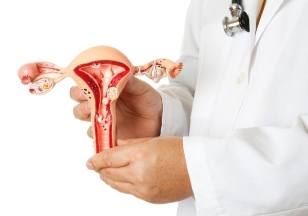 endometriose