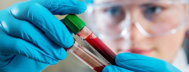 O que é leucemia, quais seus sintomas e tratamentos