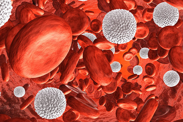 leucemia