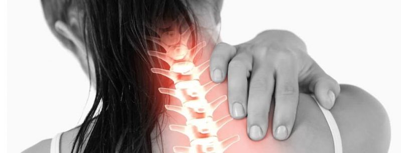 Como curar torcicolo: Veja os melhores remédios e tratamentos caseiros